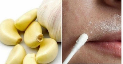 İstenmeyen Tüylere Doğal Çözüm Tüylerden Kurtulma Yolları En İyi Doğal Tüy Dökücü Azaltıcı Krem